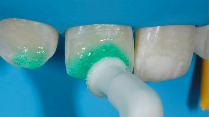Лечение зубов в томске цены томск стоматология номер 1