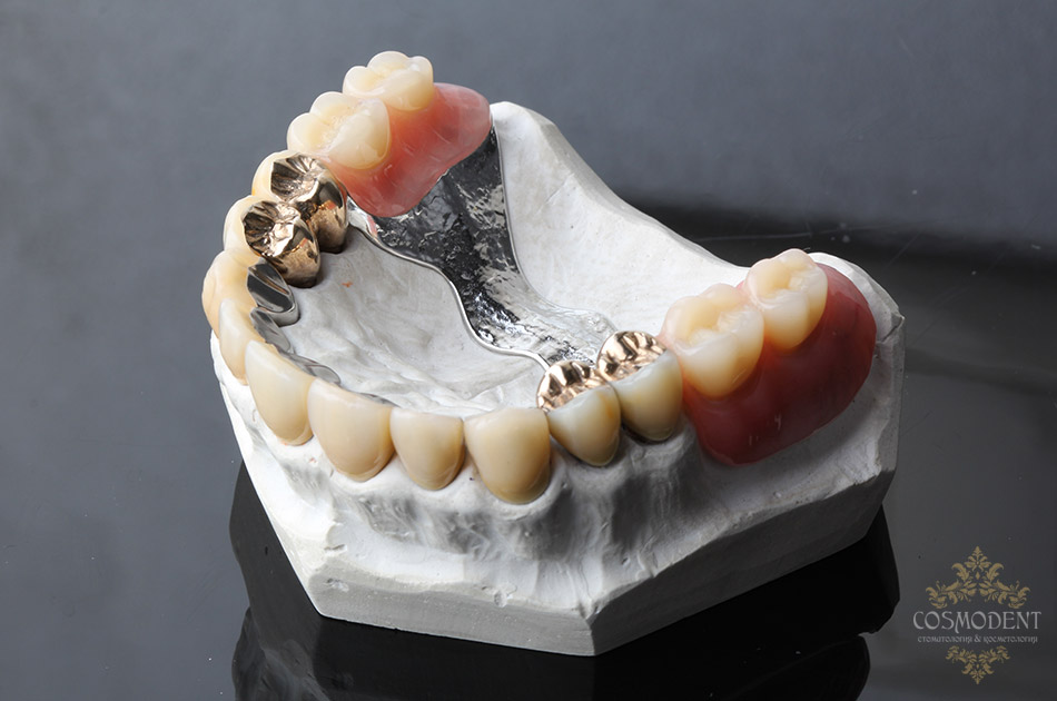 стоматология протезирование в томске